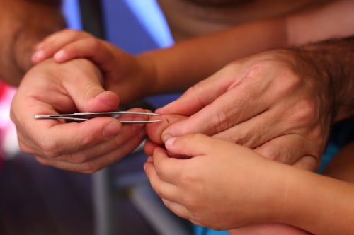 First Aid for Splinters