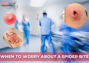 Spider Bite examples