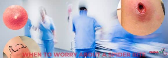 Spider Bites