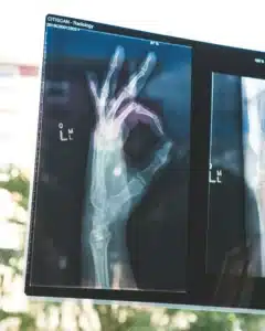 An x-ray image of a hand, revealing the internal structure and bones.