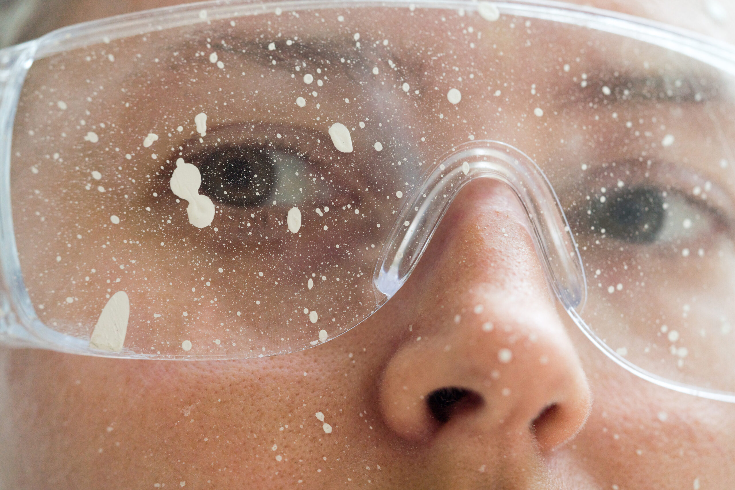 chemical eye exposure