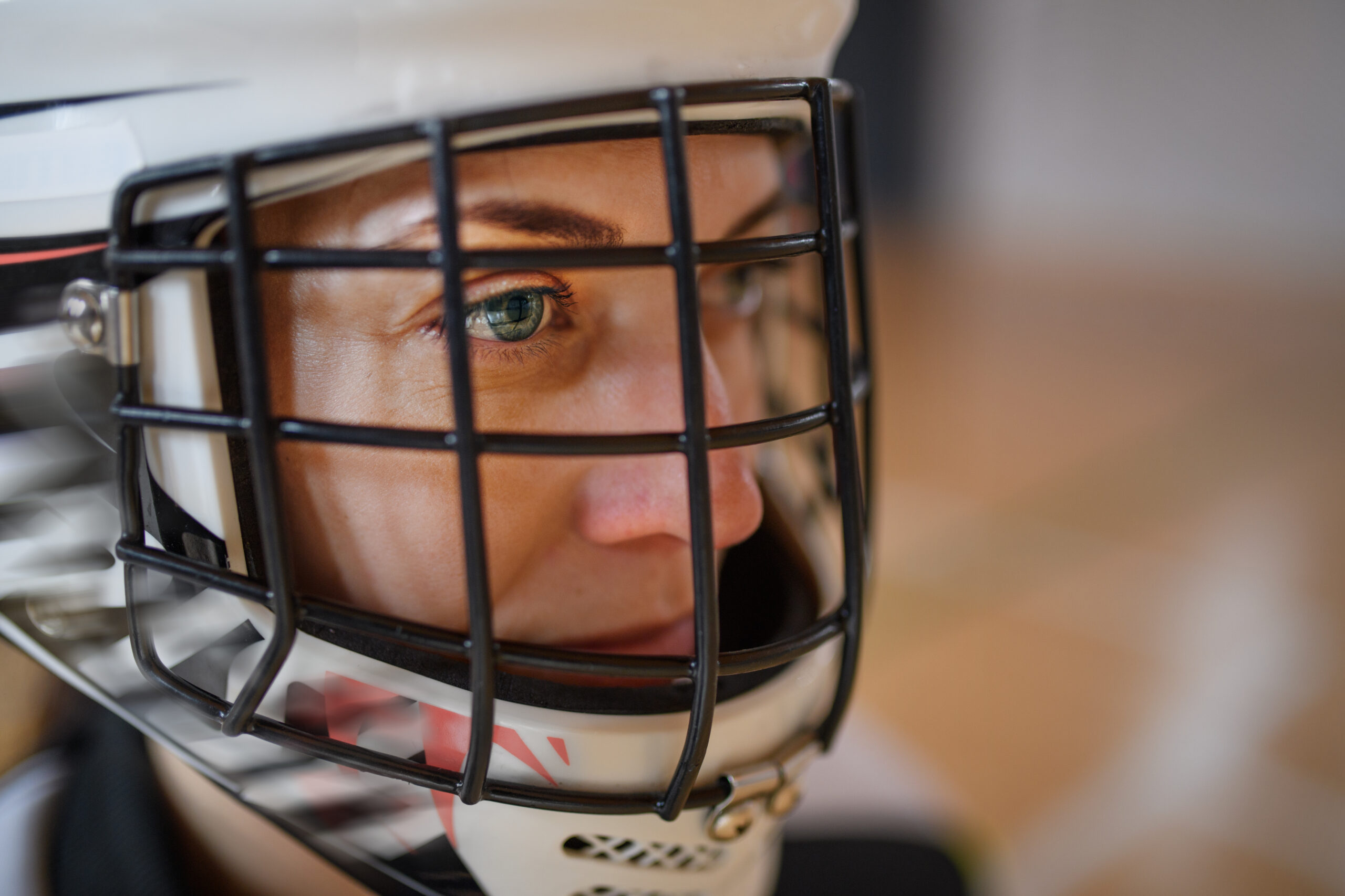 sports-related eye injuries