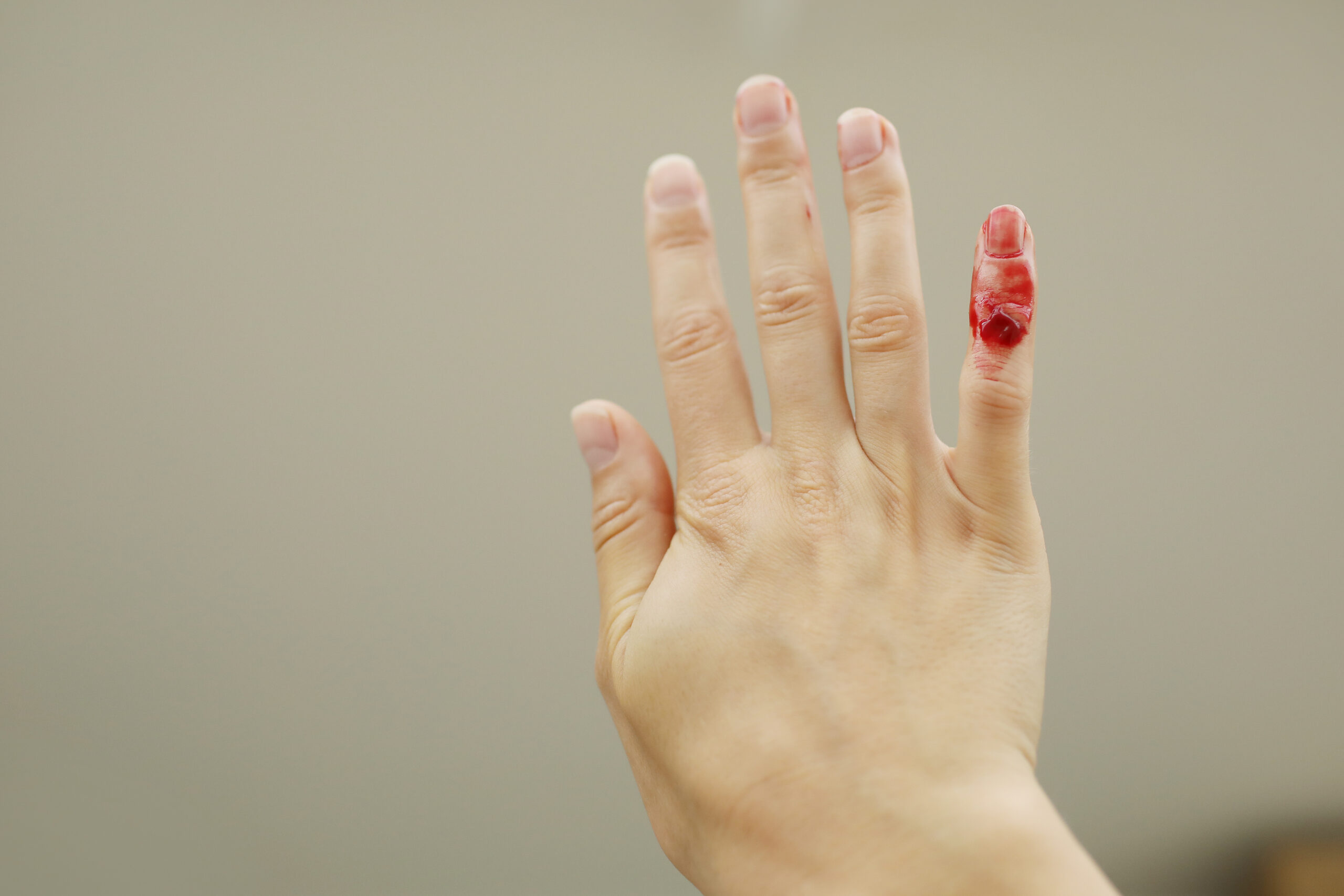Female hand with red blood, little finger is bleeding profusely. Woman injured her little finger at home with knife or other sharp object. Bleeding wound and body injury result. Domestic accident.