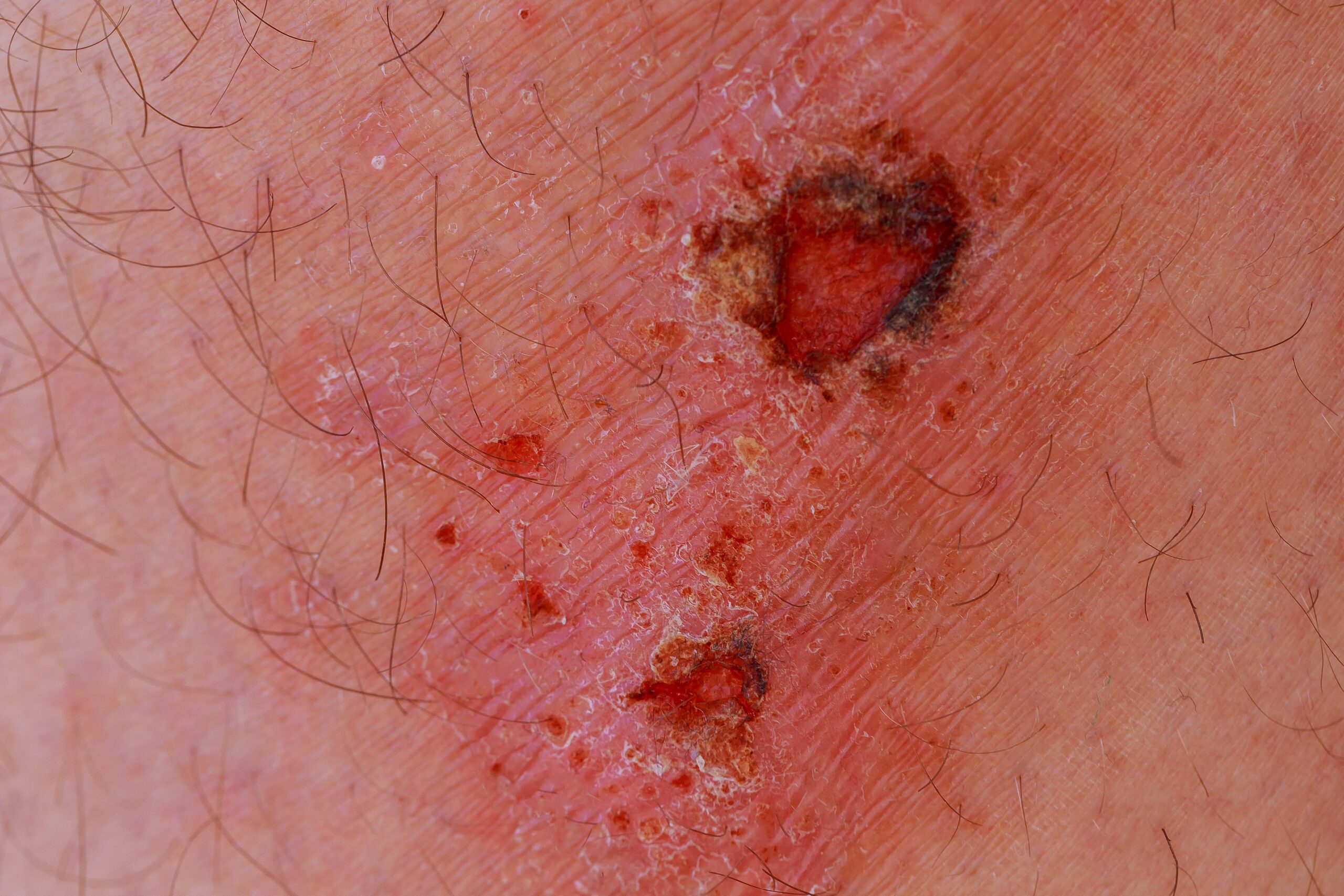 Man with a wound on his knee