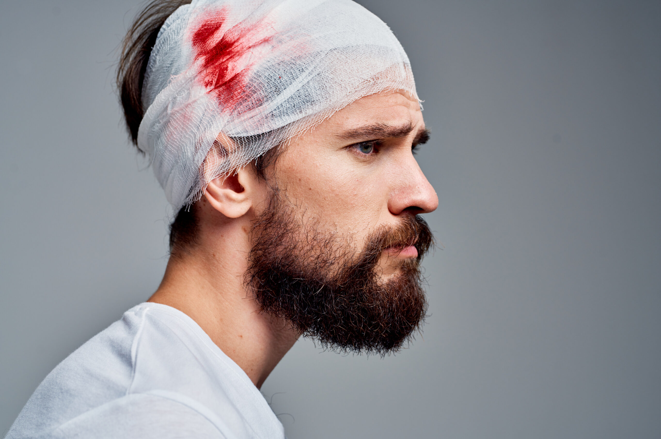 concussion care for sports injuries