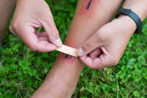 bandaid for healing minor wounds