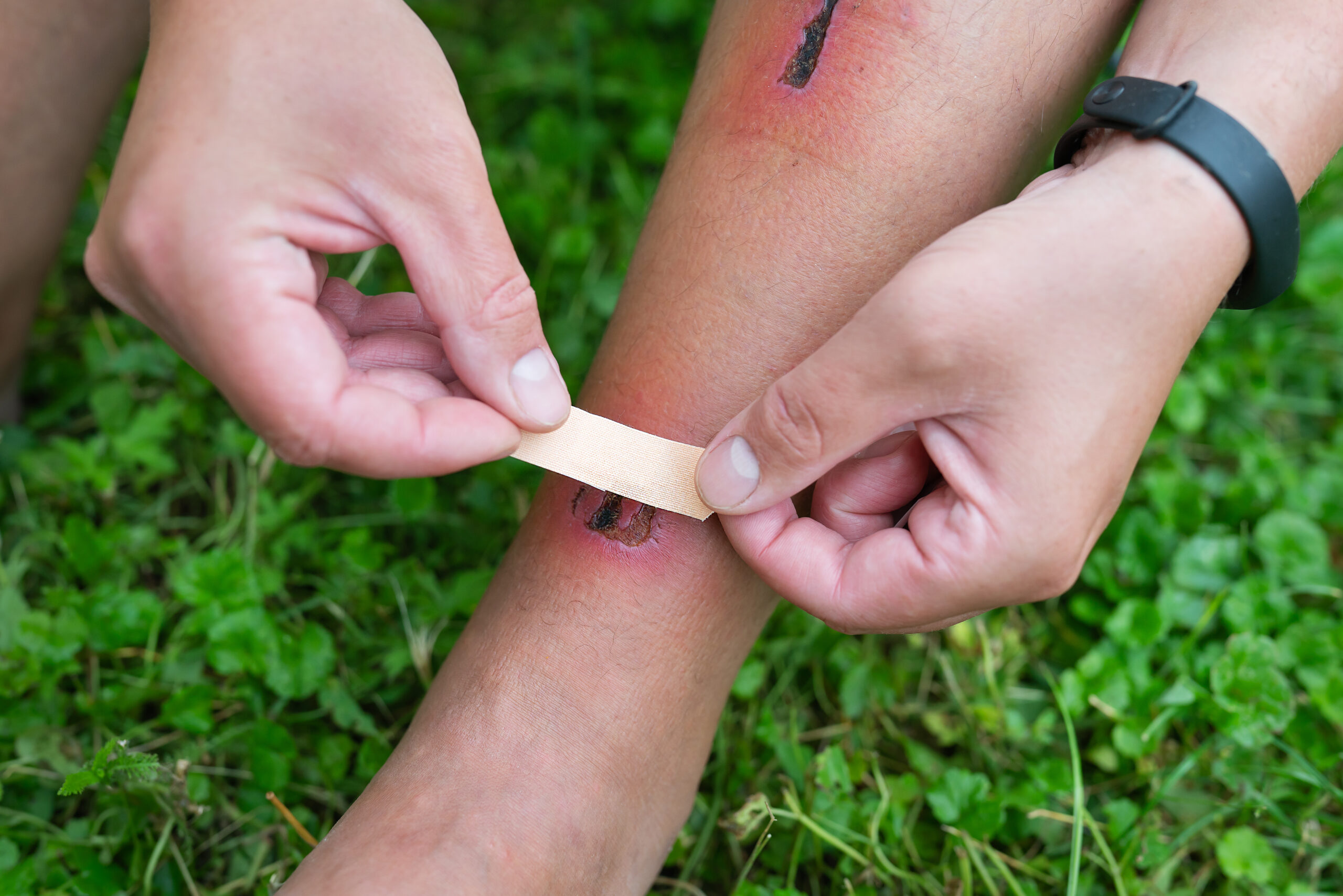 bandaid for healing minor wounds