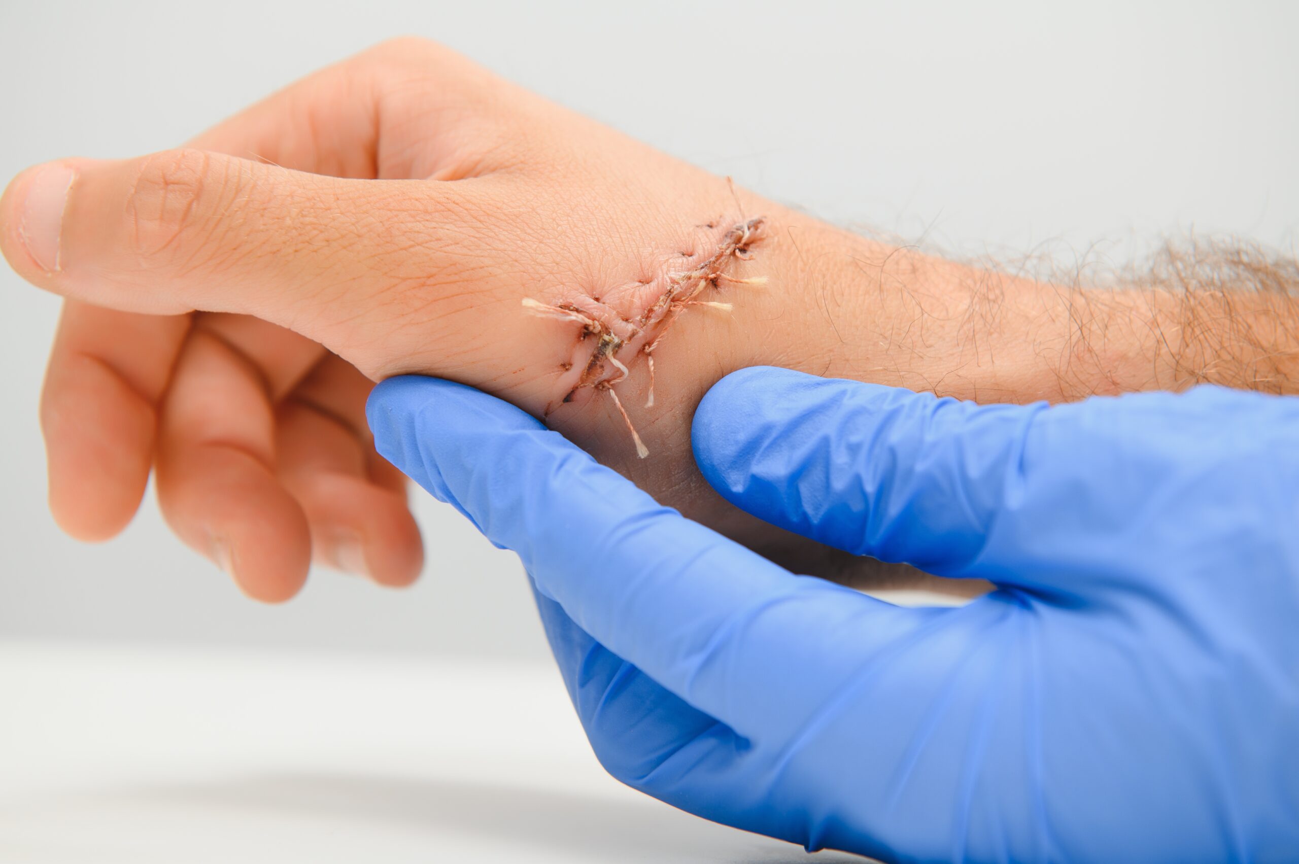 Examination and care of postoperative sutures on the patient's shoulder