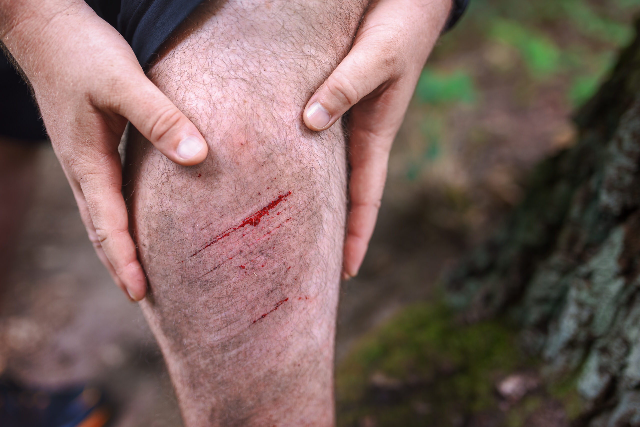 Remote First Aid Course Hobart - First Aid Pro