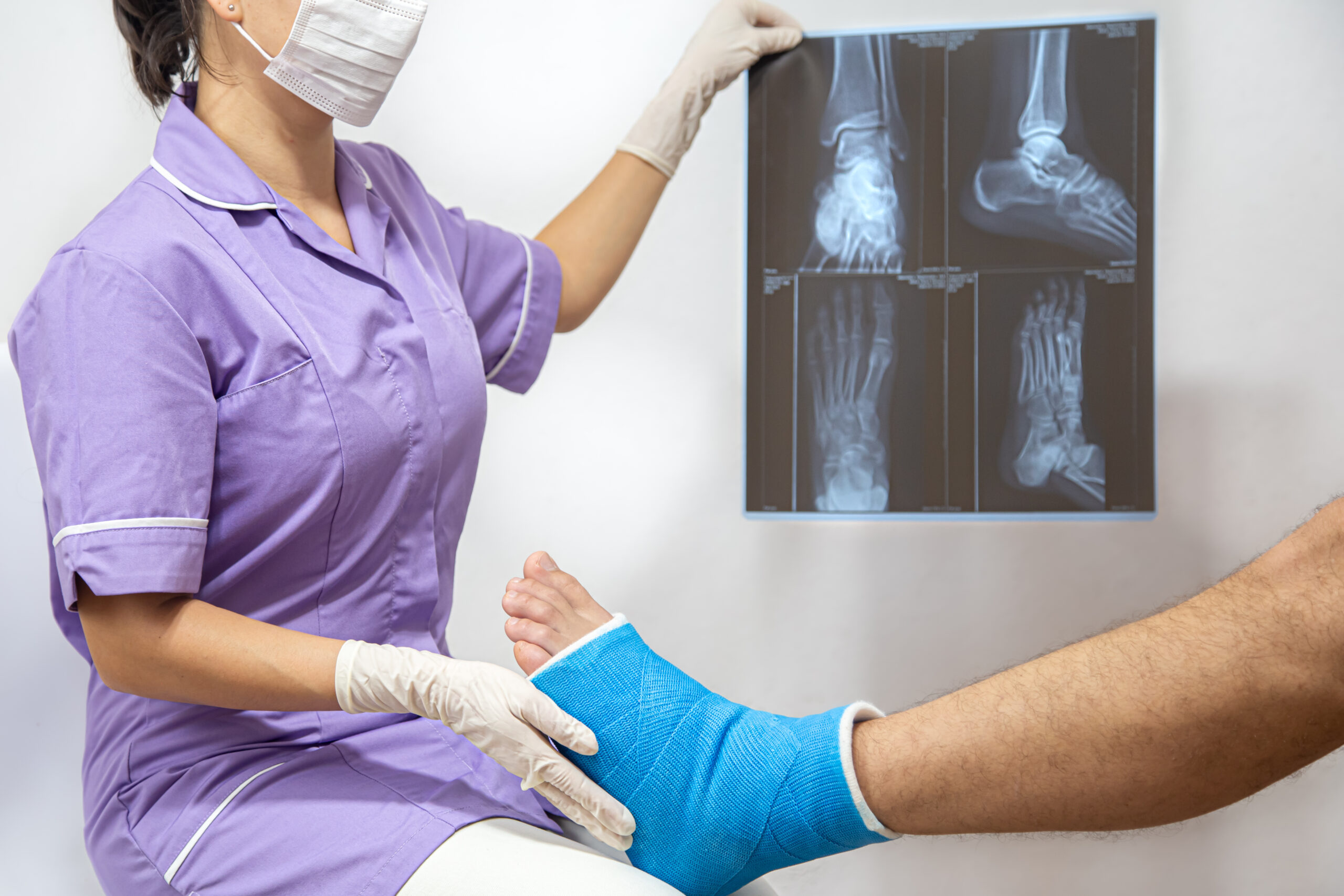 Female doctor in a blue medical gown checking broken leg and shows the male patient lateral projection x-ray of foot and ankle.