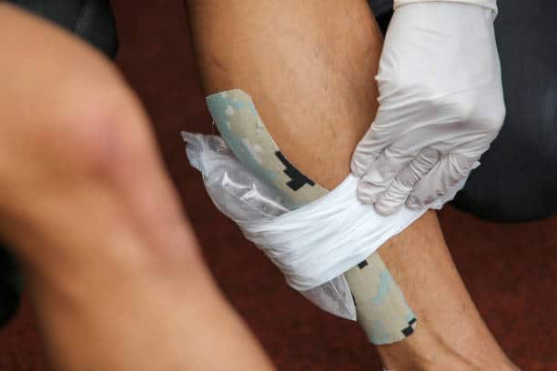 applying ice to manage swelling