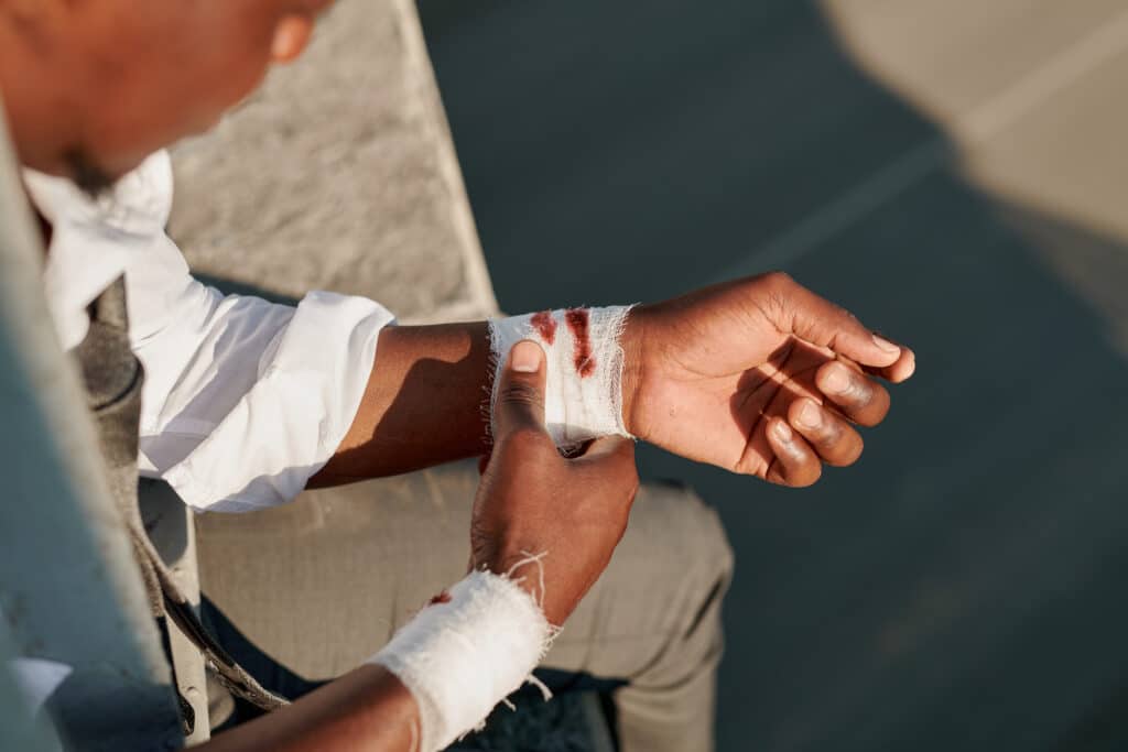 bandaged writs after bite